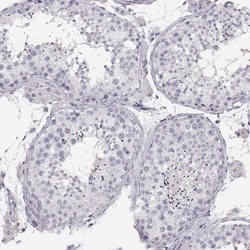 Pit1 Antibody, Novus Biologicals 25 &mu;L, Unconjugated:Antibodies, Polyclonal